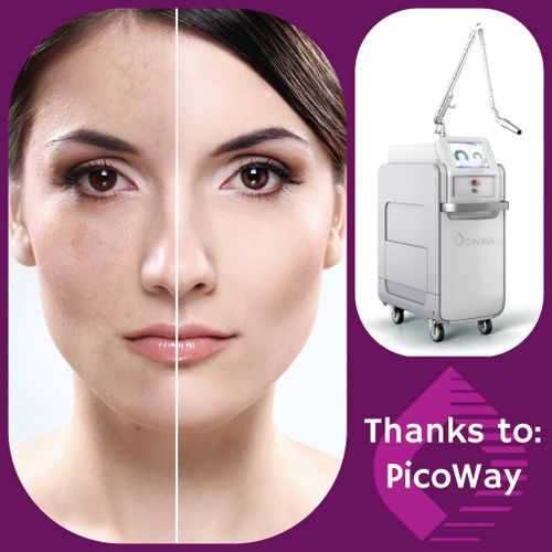 Picoway — soin chez Belle Clinique Esthetique