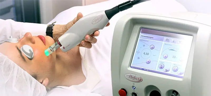 Vbeam — soin chez Belle Clinique Esthetique
